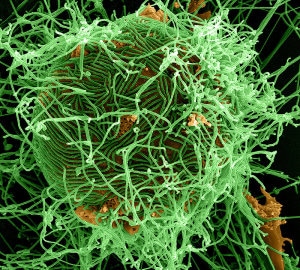 Ebola Could Infect Your Computer